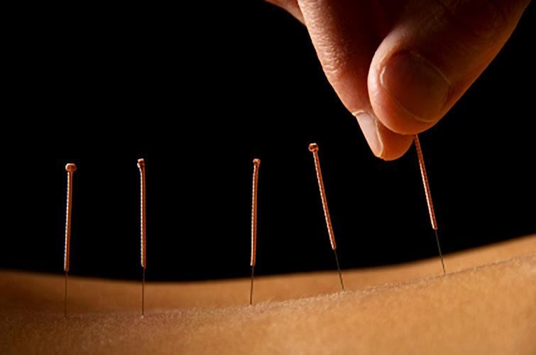 Acupuncture Alternatives, LLC clinic
