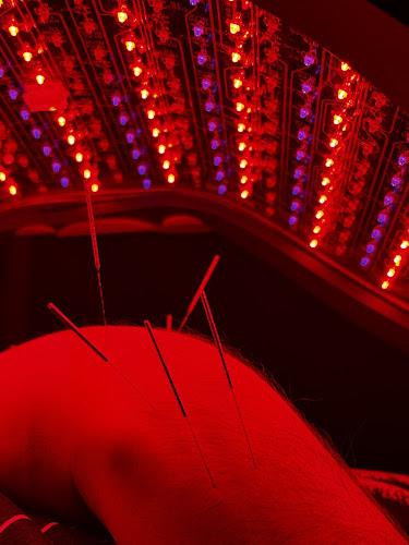 Roots and Needles clinic