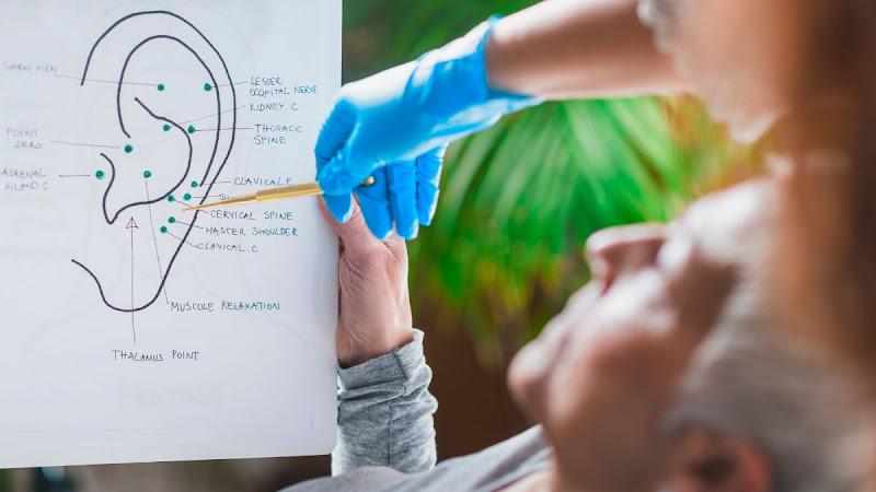 Best Acupuncture OC clinic