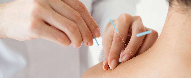 Remedē Acupuncture & Wellness clinic