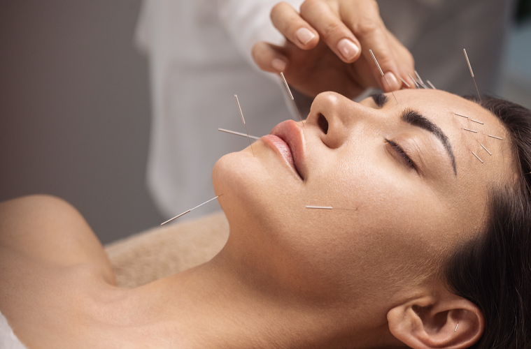 Rewild Acupuncture clinic