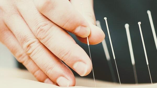 SDR Healing Acupuncture SDR針灸診所 SDR한의원 SDR鍼灸院 clinic
