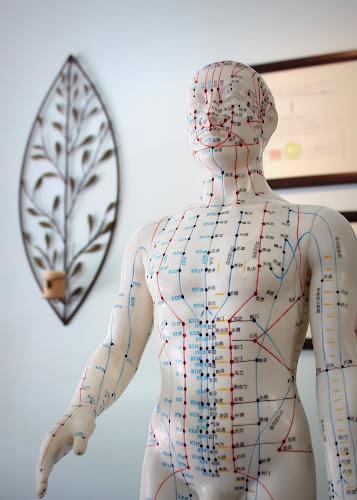 Berkeley Acupuncture clinic