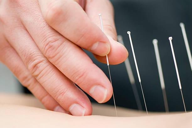 Dana Acupuncture clinic
