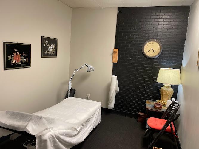 Acupuncture By AcuSpa clinic