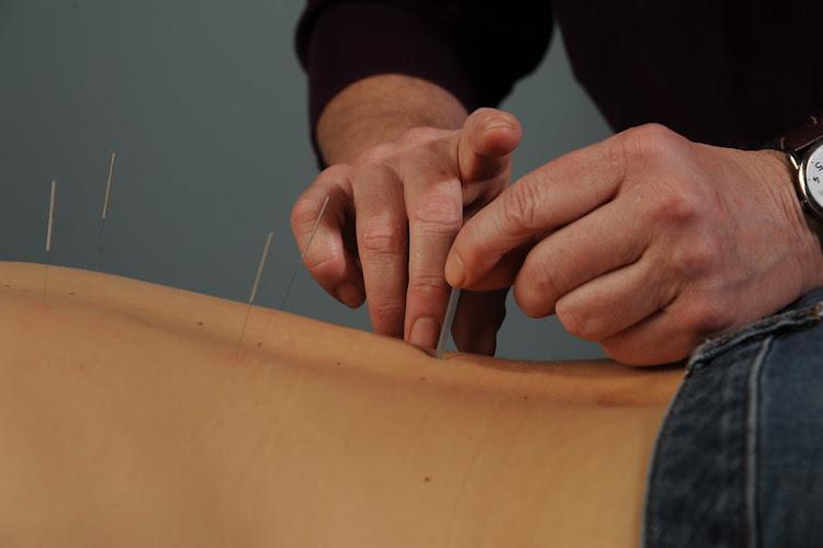 Acupuncture @ Inner Courtyard clinic