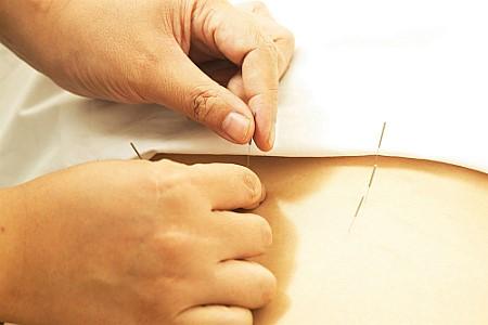 JK Acupuncture & Herbs Clinic clinic