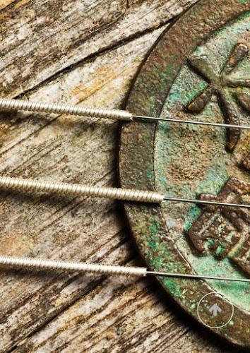 Acupuncture with Melissa clinic