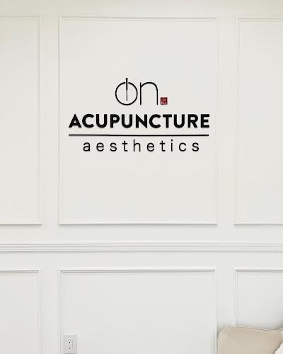 On Acupuncture clinic