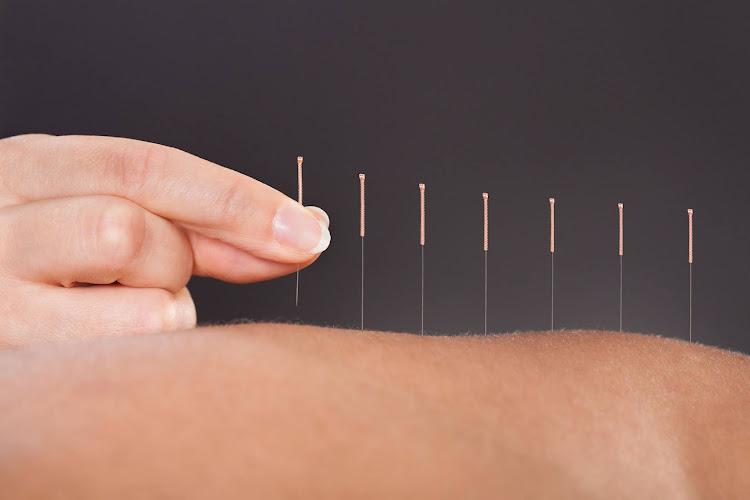 Sana Acupuncture & Wellness Center clinic