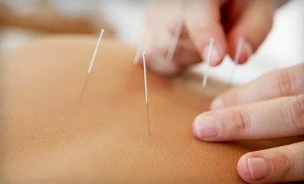 Bronx Acupuncture clinic