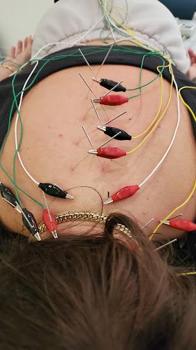 Hoots Acupuncture PLLC clinic