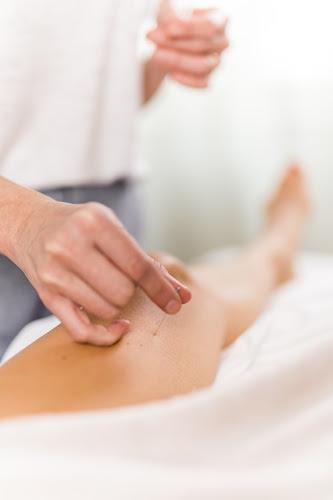 ArTeva Acupuncture clinic