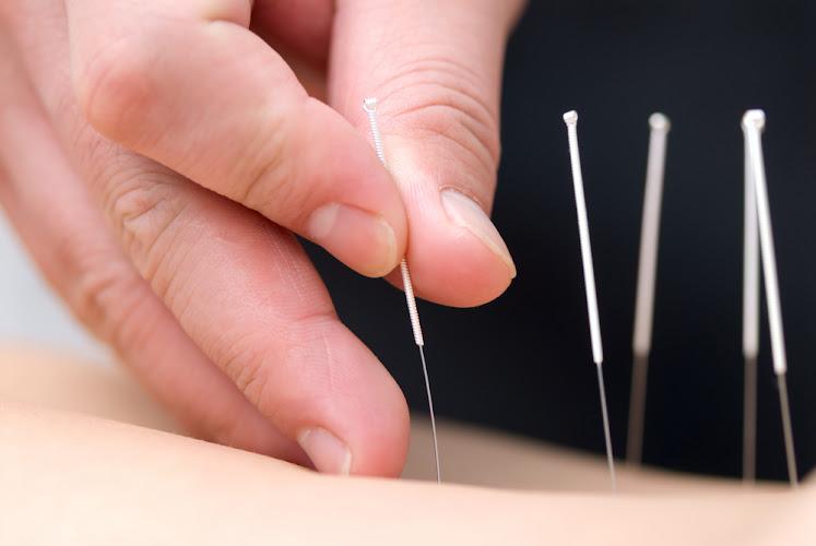 NYC Acupuncture clinic
