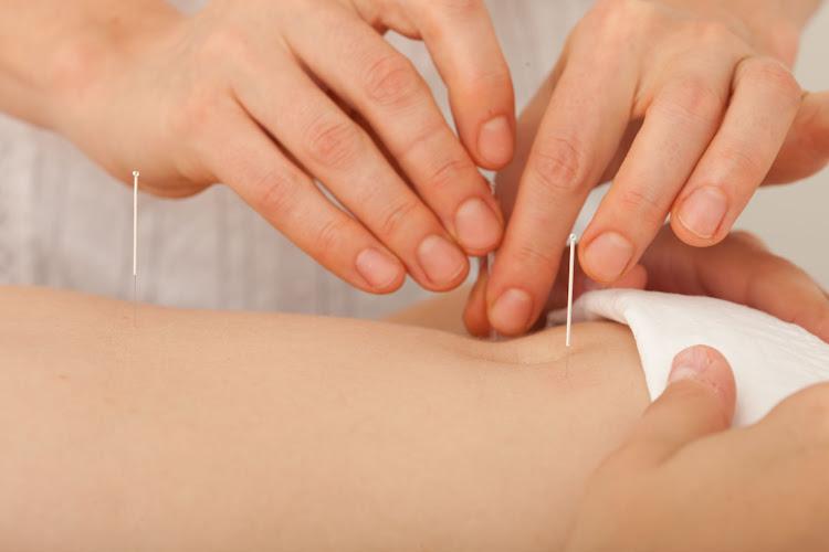 Samantha Story Acupuncture clinic