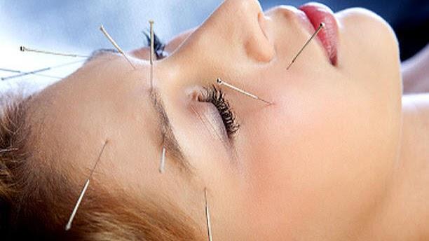 Ying Acupuncture Center clinic