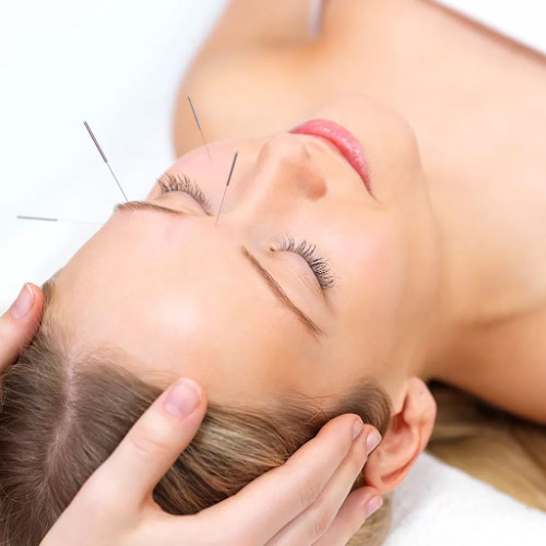Yonkers Acupuncture clinic
