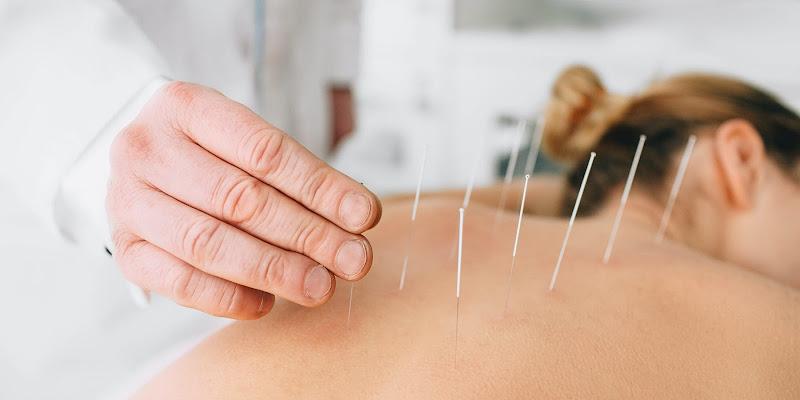 AAHOM Acupuncture clinic