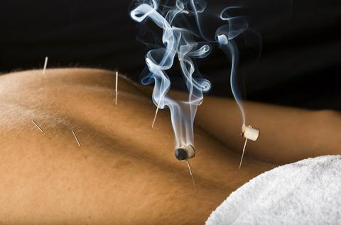 Stillpoint Acupuncture clinic