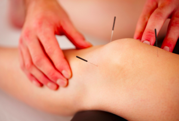 Umpqua Acupuncture clinic