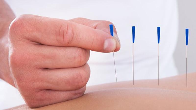 Murrysville Acupuncture clinic