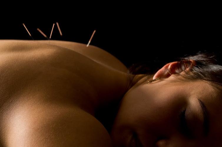 Acu-Care Acupuncture Clinic, Inc clinic
