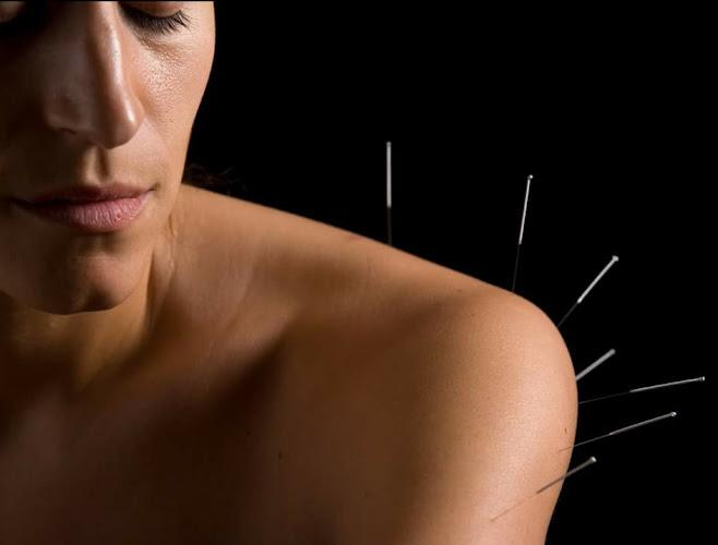 Wellbridge Acupuncture clinic