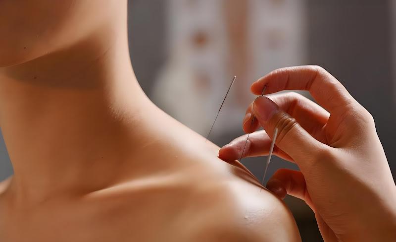 Peace Finder Acupuncture Clinic clinic