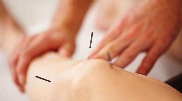 Acupuncture Chang - Xiong Chang clinic