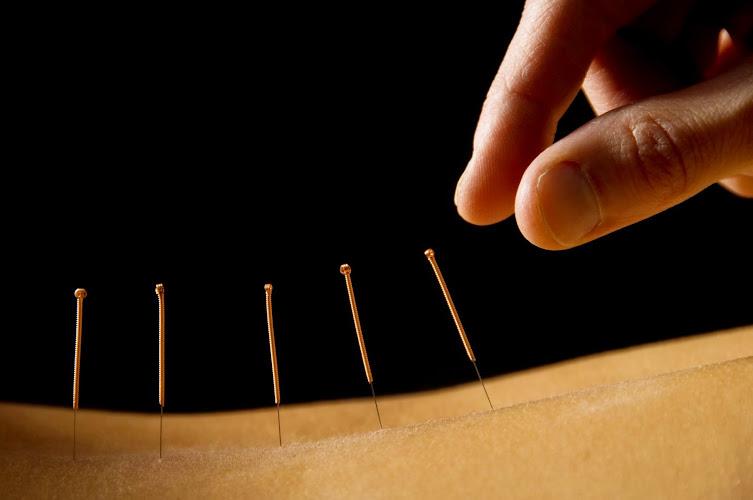 Acupuncture & NAET Center clinic