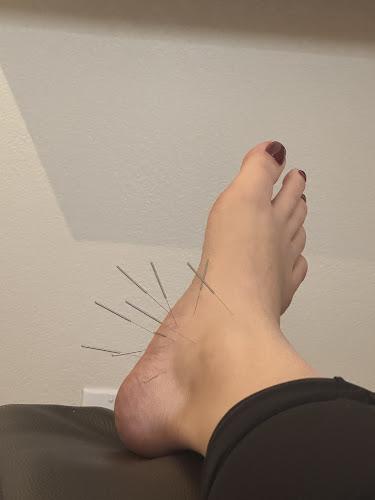 American Acupuncture clinic