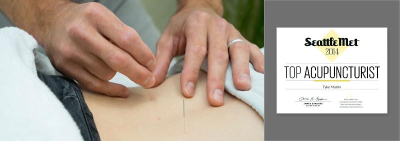 Fit Acupuncture clinic