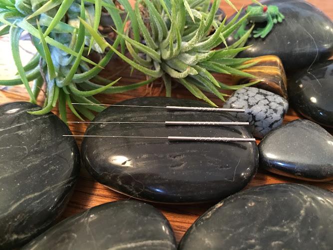 Misty Mountain Acupuncture clinic