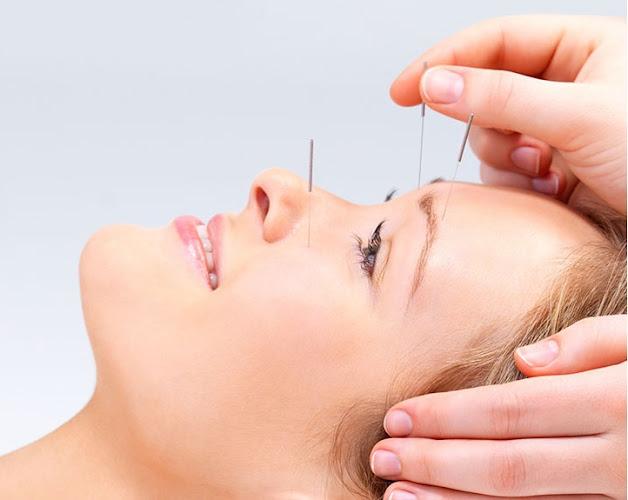 Acupuncture for Everything! LLC clinic