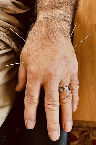 Milwaukee Community Acupuncture clinic