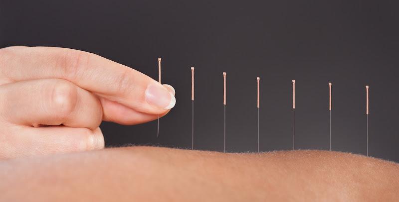 Lander Acupuncture & Bodywork clinic