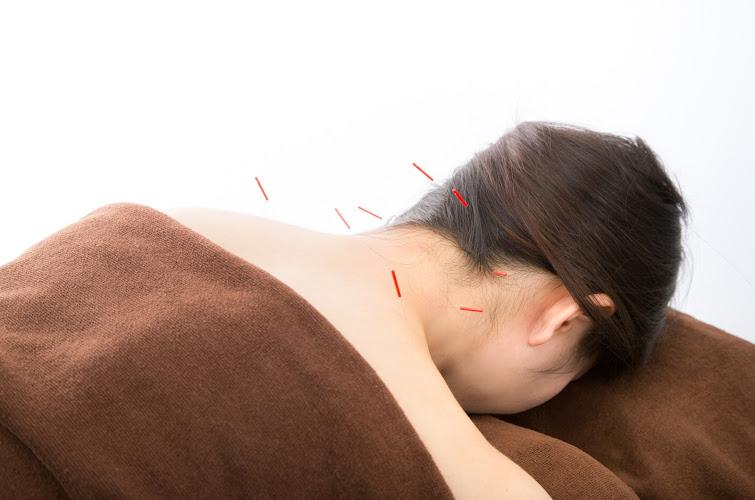 Shizue Hayashi Ito Acupuncture (Inside Best Chiropractic) clinic