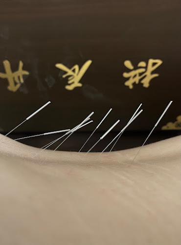 Han Acupuncture Health Center near Encino clinic