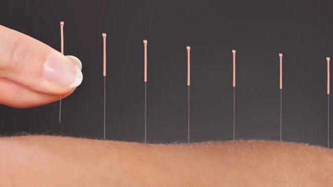 Northwest Indiana Acupuncture and Massage clinic