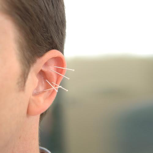 Brett VanCott Acupuncture: Dragonfly Oriental Medicine clinic