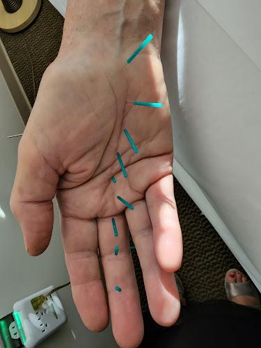 Acupuncture and Natural Medicine Clinic clinic