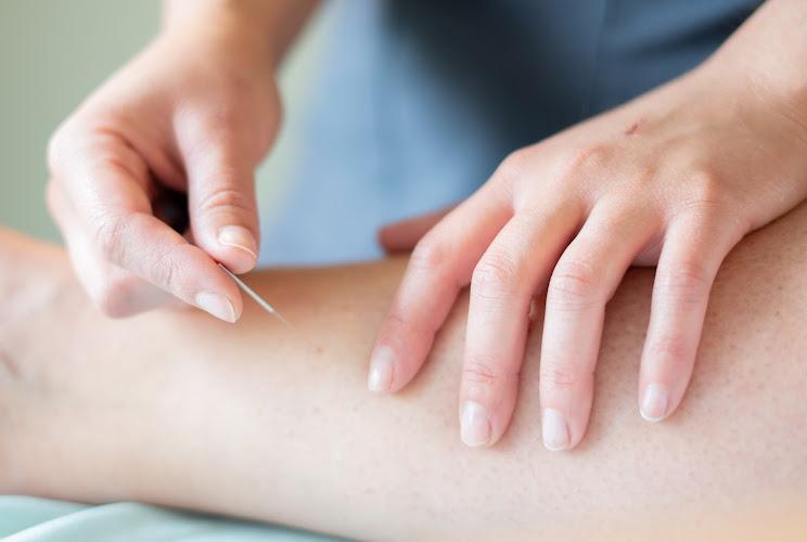 Essence Community Acupuncture & Herbs clinic