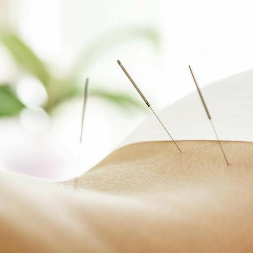LouLou Piscatore, L.Ac. - Integrative Acupuncture clinic