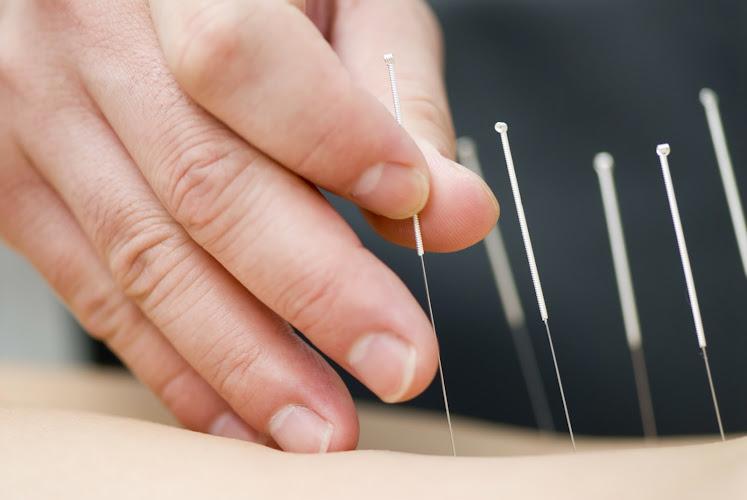 Acupuncture & Alternative Medicine of Staten Island clinic