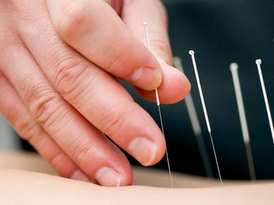 Avenzoar Acupuncture & Wellness Center clinic