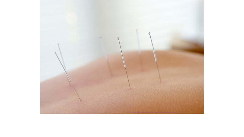 Acupuncture & BodyWorks by Debra Baker C.Ac., LMT clinic