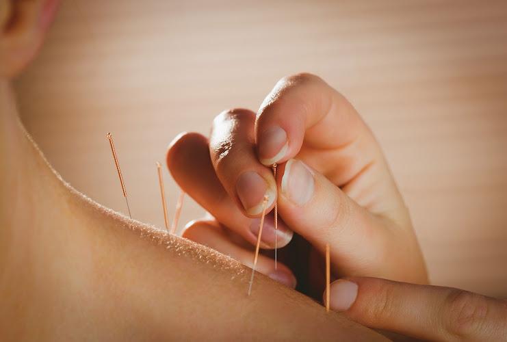 Vital Source Acupuncture of Kingston - Jacqueline Stefanski L.Ac. clinic