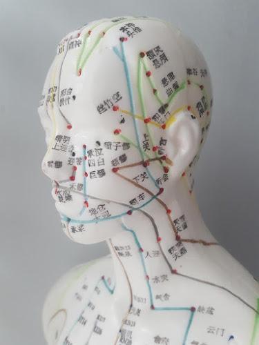 Philadelphia Gateshead Acupuncture clinic