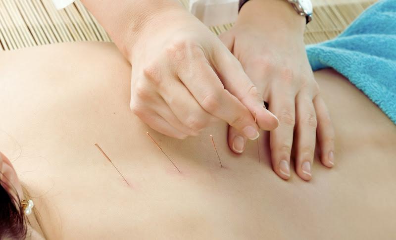 Acupuncture Specialists & Wellness Center clinic