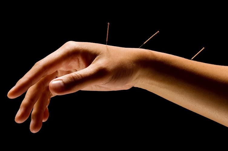 American College of Acupuncture & Oriental Medicine (ACAOM) clinic